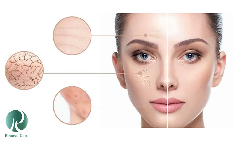 مراقبت از پوست خشک مراقبت از پوست خشک