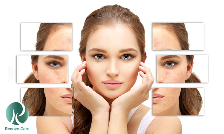 راهنمای خرید محصولات مراقبت از پوست برای انواع پوست: خشک، چرب، حساس و مختلط